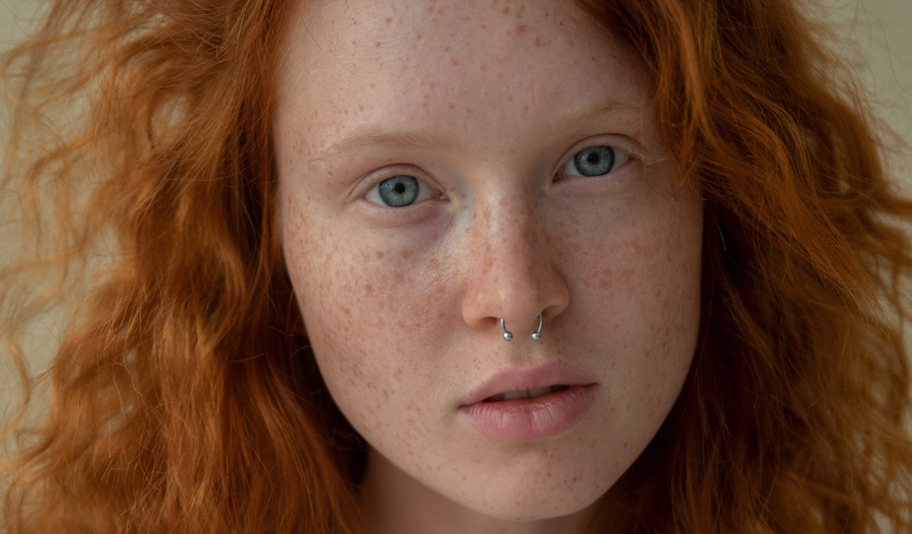 Chéloïde au Piercing : Explications, Causes & Solutions