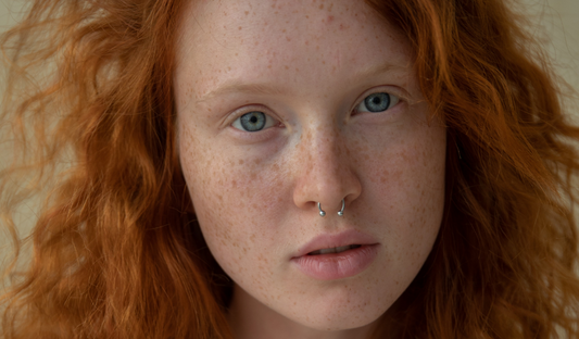 Chéloïde au Piercing : Explications, Causes & Solutions